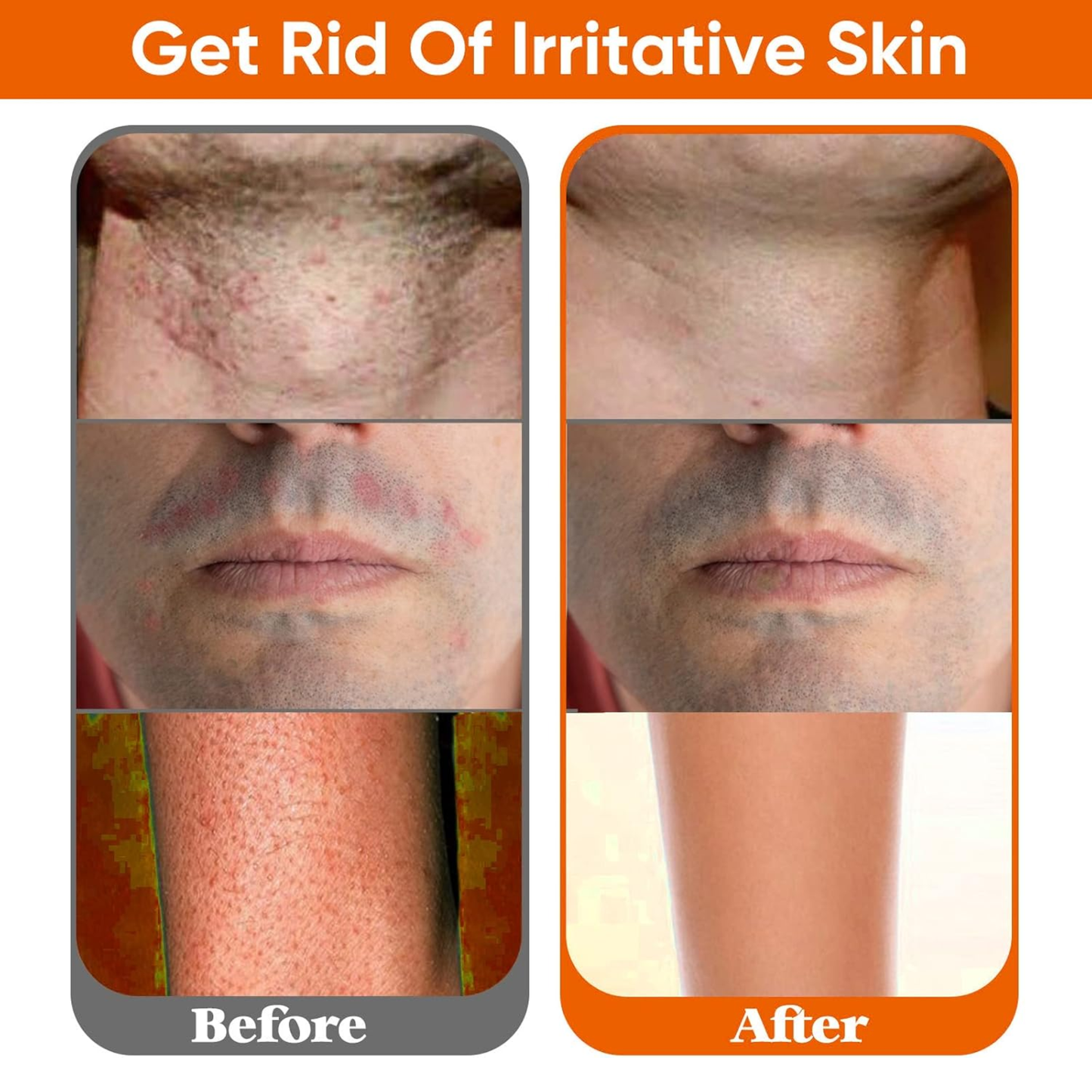 Clear Pass Ingrown Hair Roll-On Serum