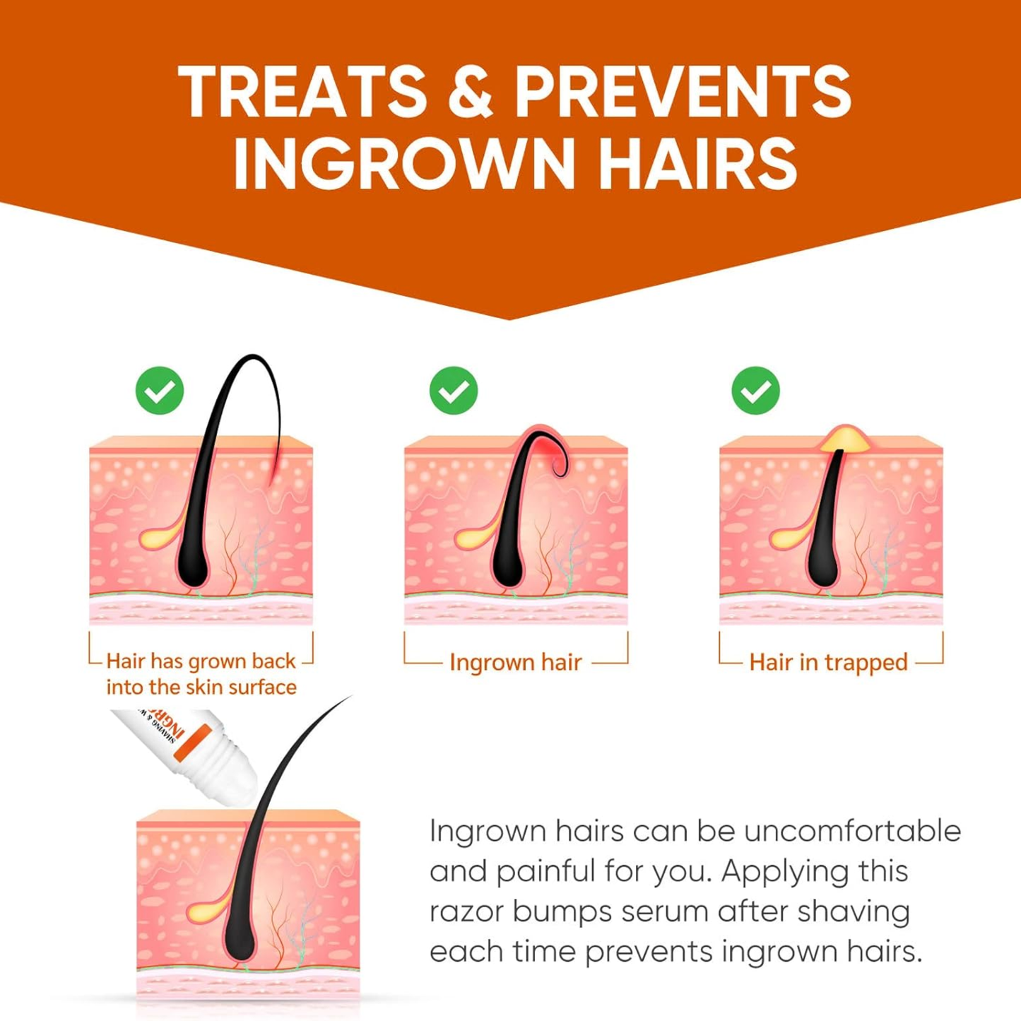 Clear Pass Ingrown Hair Roll-On Serum
